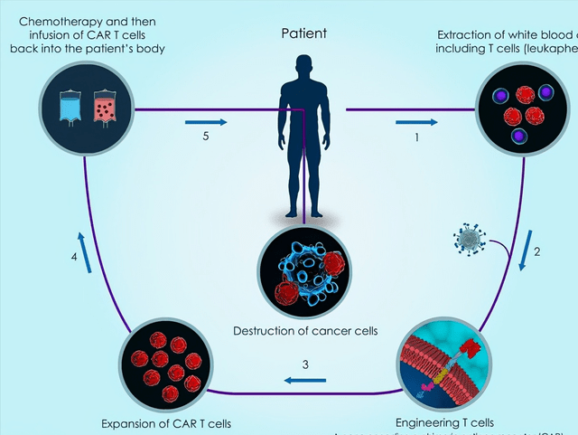 car-t細胞療法到底是什麼?為何如此貴?