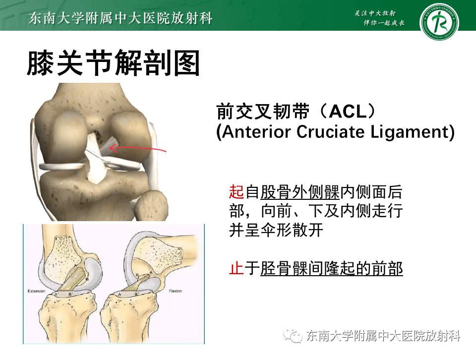 膝关节前交叉韧带损伤