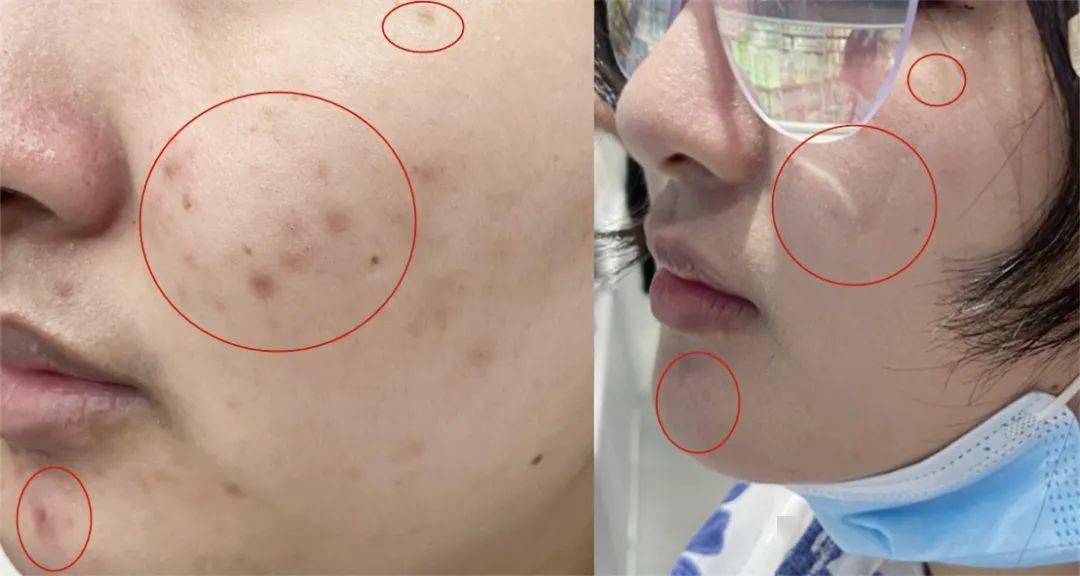 凯特36岁艳绝皇室？英国王妃凯特近照美翻！网友看到键盘都敲烂了