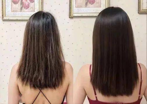 头皮头发总掉竟是「发根」缺了它！简单一招，5天生新发！发量重回18岁