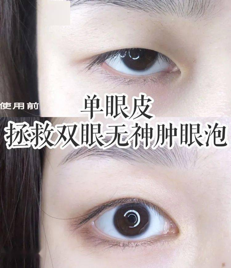 有明目之效常用于目暗不明,青盲内障氨基牛磺酸,白色结晶体人体所需的