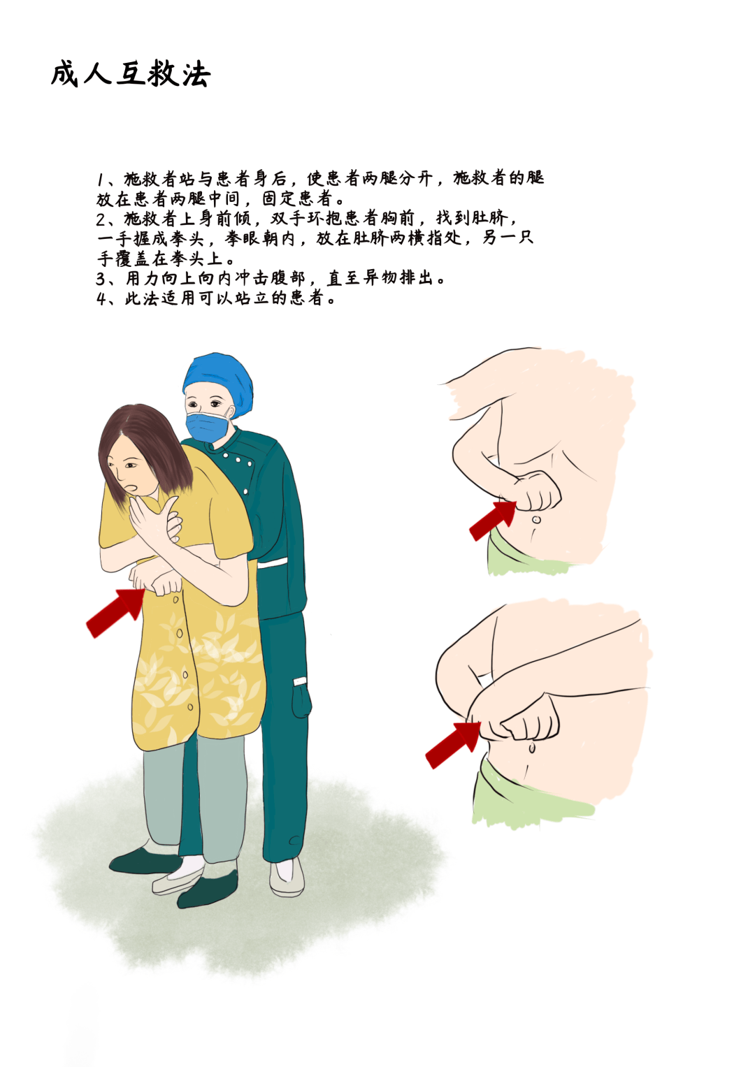 一图读懂海姆立克急救法关键时刻能救命