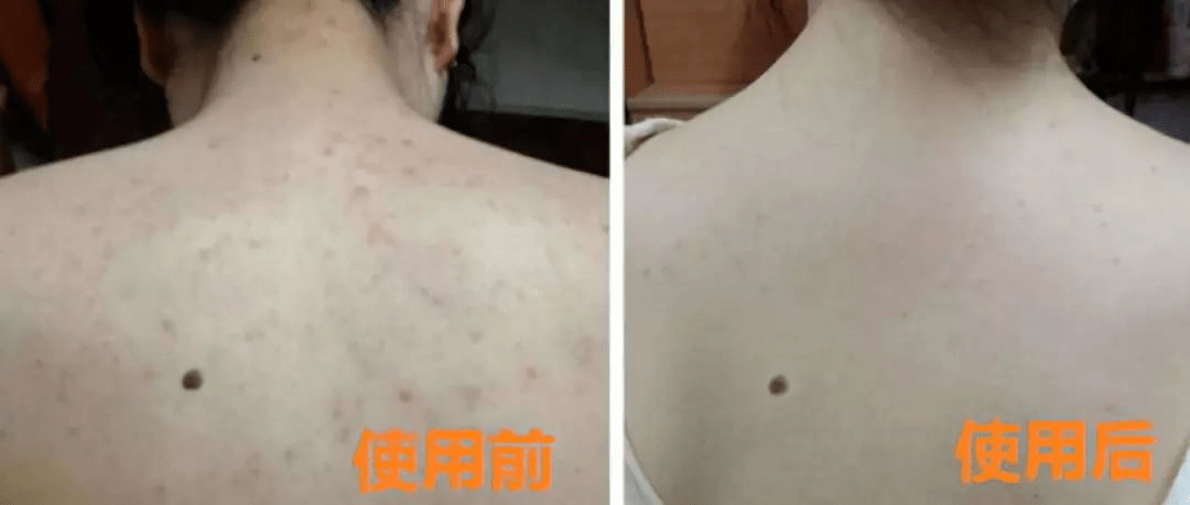怎么能让皮肤不痒 cbf764d8fce54157b5cbe9dfe5be867b.png