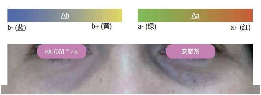 眼睛99元2支！屈臣氏卖断货的电动眼霜，搞定黑眼圈、肿泡眼