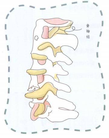 頸椎病康復之誰弄疼了我的頸部及結構小常識