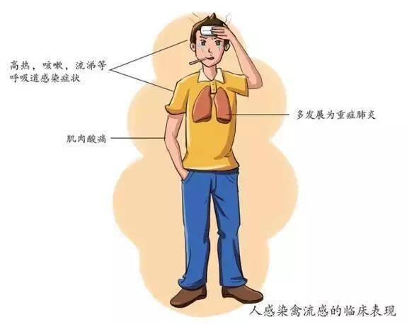 人感染禽流感有哪些症状?