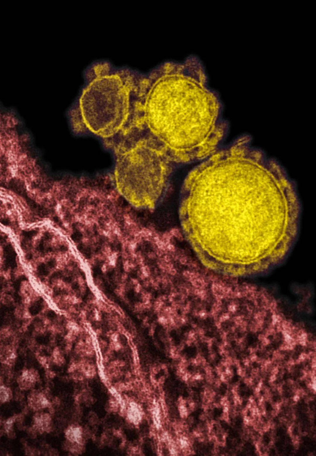 特辑:当世界放大100000倍_病毒_疫情_宿主