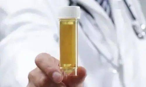 复查|注意!体检指数异常没放在心上,广东34岁女子确诊慢性肾衰竭!