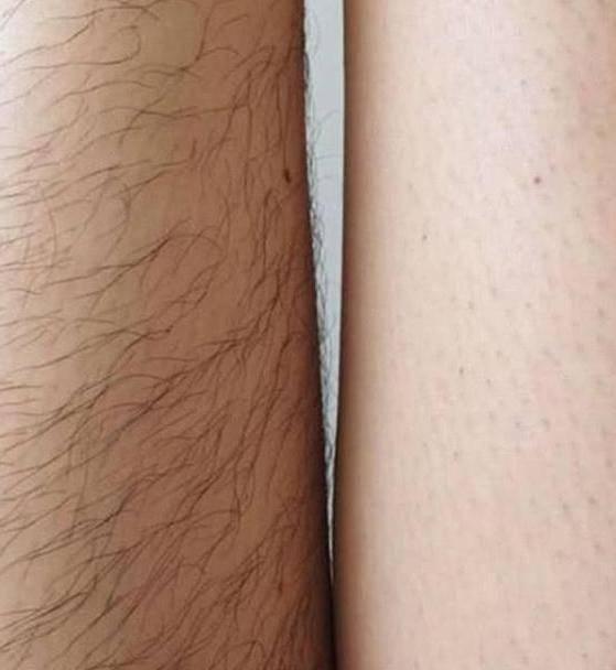 女大学生腋下双腿留体毛被批 本人回复 我只是想顺其自然 脱毛 Laura 女生