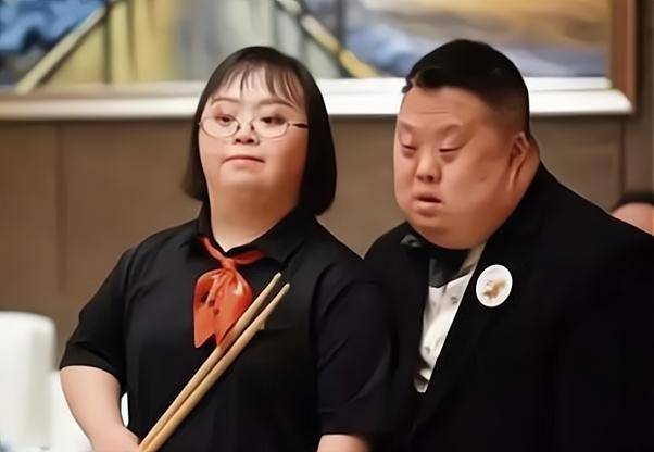 为何患有唐氏综合征的孩子,长相都差不多?看完你就明白了