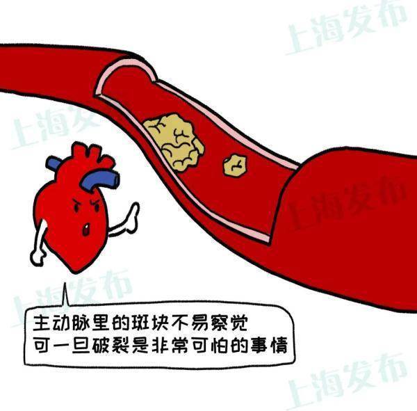 症状|@三高人群，怎样远离心梗/脑梗的威胁？