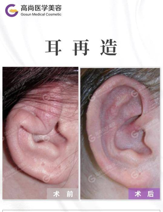 小孩子做手术全麻多久可以醒 aba6868b542c4aa995c3cd3f8a218a59.jpeg