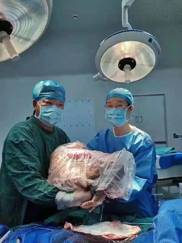 徐女士|惊险！广州医生切下24斤巨大肿瘤，需两人合抱