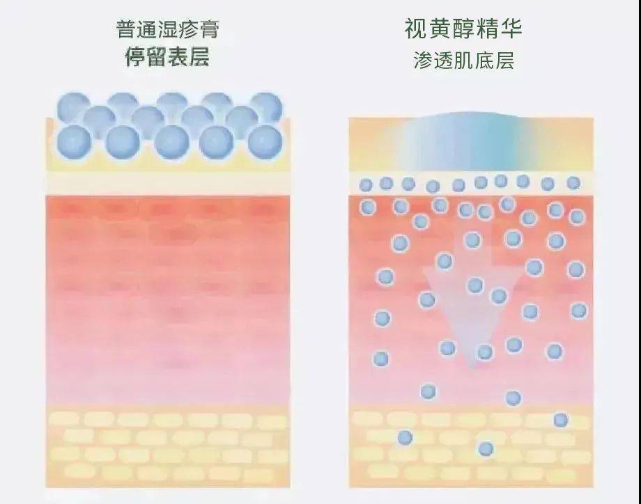 产品10层粉底也遮不住脂肪粒？这个方法简单快速，教你处理它的正确姿势~