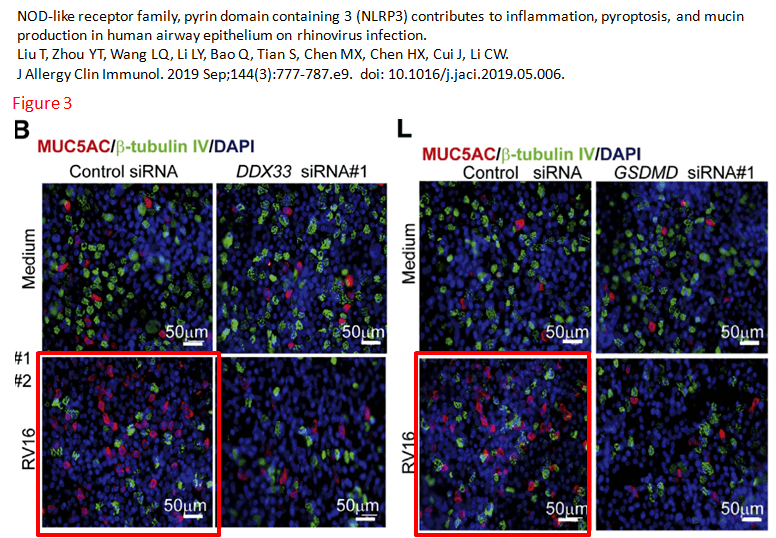 染色(红色)一模一样,并与明显不同的β-tubulin(绿色)和dapi(蓝色)