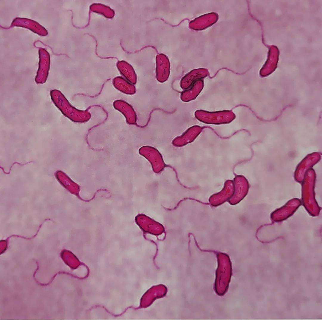 齿垢中的细菌革兰染色图片