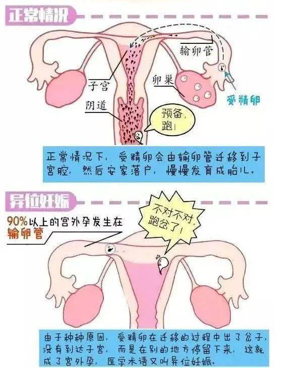 輸卵管_陰道_生殖