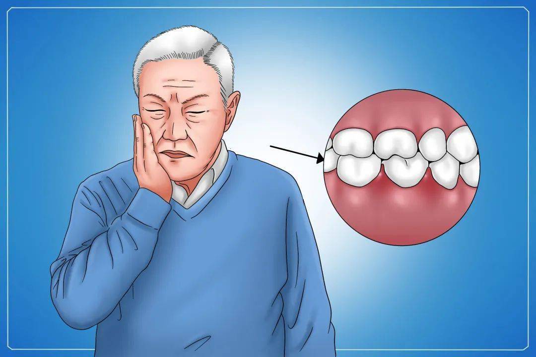 血管|健康丨糖尿病不只是血糖高那么简单