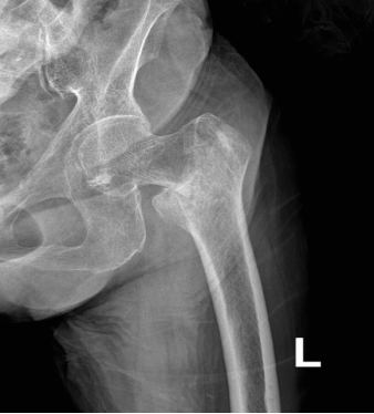 怎样快速有效治疗血栓 97beabcc00bc480bbe63fc5fc54efa3b.png