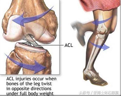 译文分享 Acl前交叉韧带损伤康复训练方法与流程 膝关节 膝盖 动作