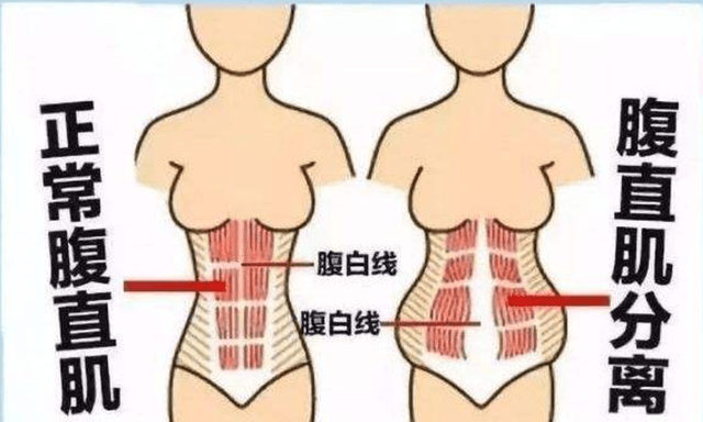 什么是生图 8647862e248c496f8e8bc2d9c6fd4168.png