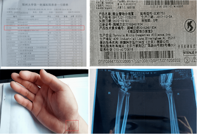 腹腔穿刺术操作步骤记录 9604aa4a9d064f489167aa8d2bf76b8d.png