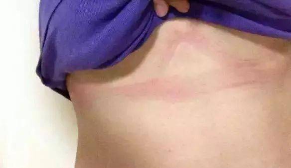 乳房|还在“糟蹋”乳房吗？试试这样穿，胸型饱满有气质