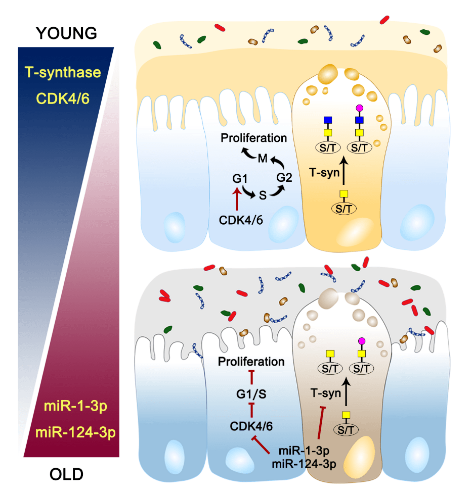 基础医学院周德山教授团队jcrohnscolitis阐述老化肠上皮黏膜屏障受损