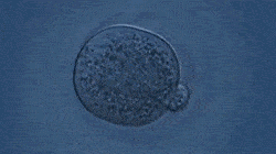 bc6f7f0e3156491e87bad72bb7661578.gif