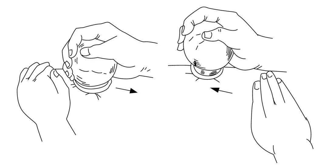 瘢痕的拔罐治疗