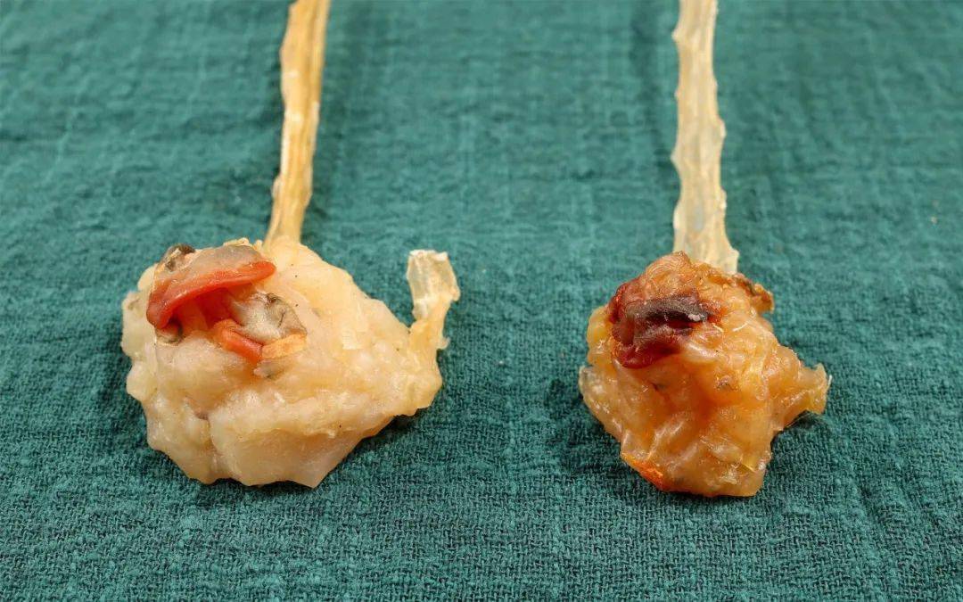 今日秒杀 | 这个深海"明目鱼",能把"水"补到眼睛上._日月_秋冬金_东西