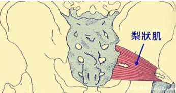 腰脱压迫神经怎么办
