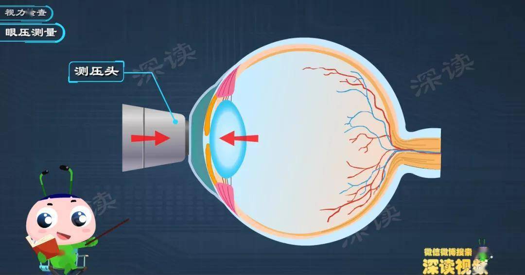 最新消息看眼底就能查青光眼动漫科普青光眼检查黑科技