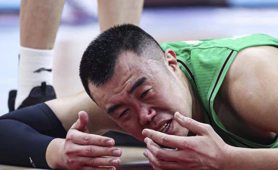 太气了 韩德君伤情公布 鼻骨骨折 面部变形 鼻子肿了睁眼都难 杜锋 辽宁 广东