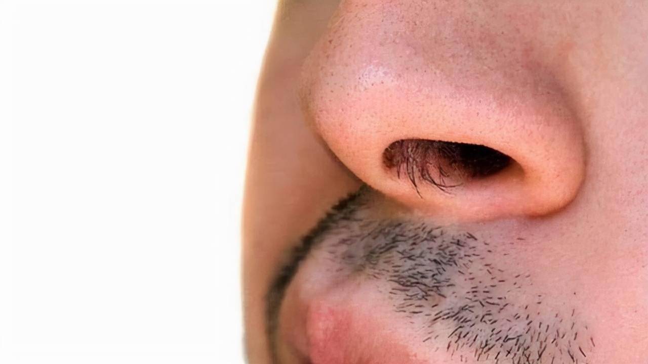 男的鼻毛多是怎么回事(男性的鼻毛为何会窜出来) - 医药经