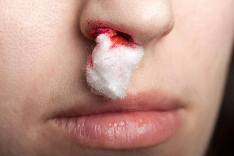 红霉素软膏 鼻子图片