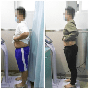 广医|16岁少年三个月减重18斤，专家：青少年肥胖需引起重视
