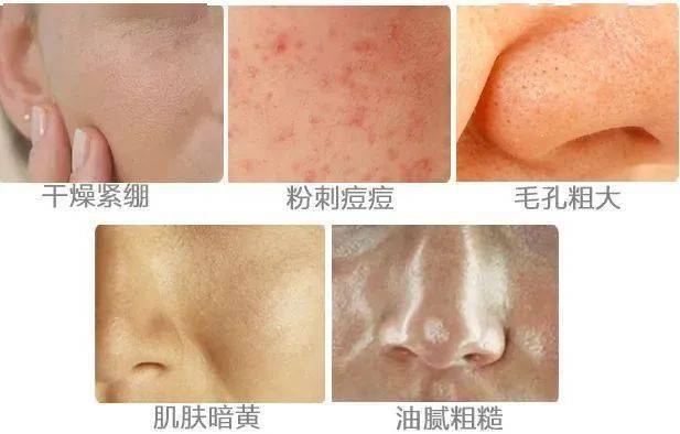 什么新年捡漏:海蓝之谜精萃水/面霜/眼霜直降1000!抱歉,这么大优惠说晚了...