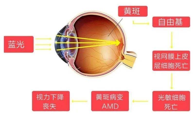 黄斑位置图片