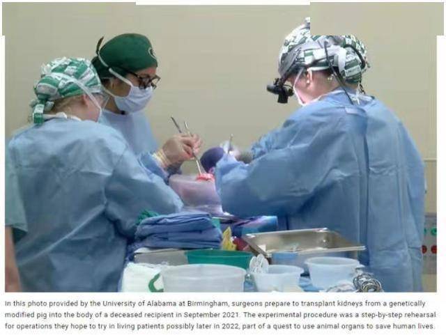 美国科学家又报告一猪器官移植实验，这次是给人移植猪肾