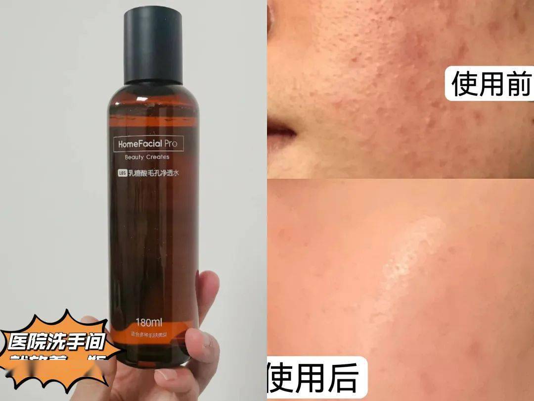 黑头翻车震惊全网的阿娇，高调复出后脸都变了？？？