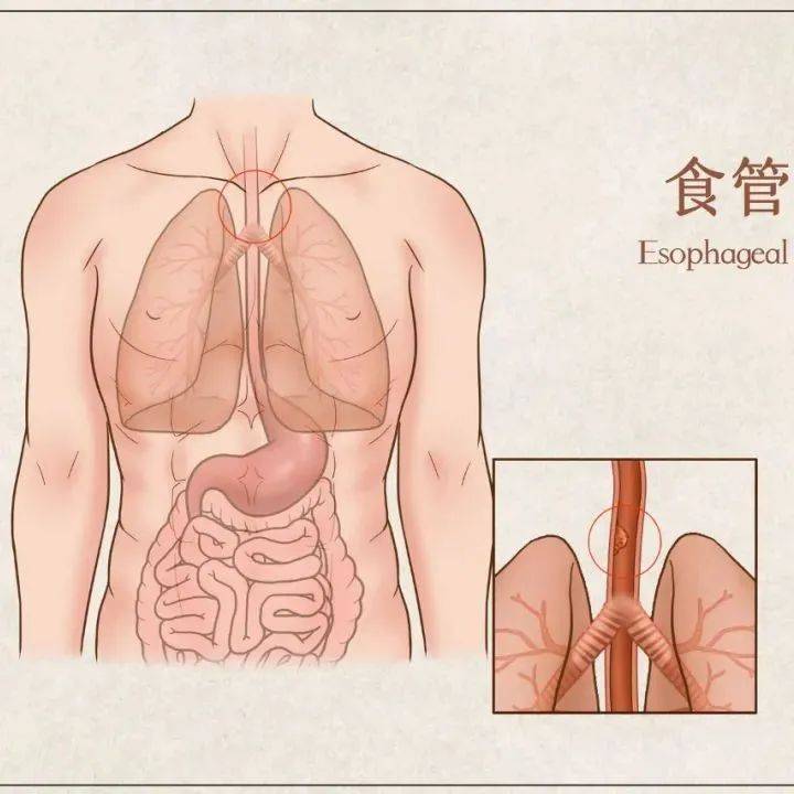 食道炎最常见的症状