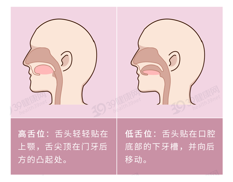 氣道變窄鼻呼吸受到影響讓人養成張嘴呼吸的習慣這會使人變得越來越醜