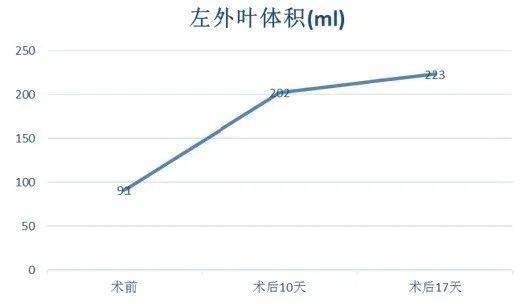 肝脏|【首儿医典】肝母细胞瘤