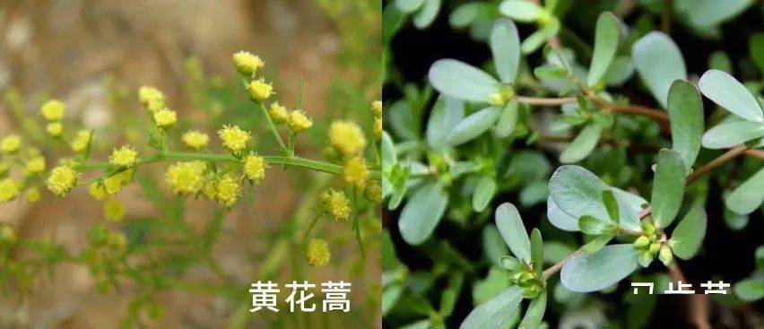 尸体头上抠下来的白泥竟是螨虫尸体!头痒头屑出油多,用它就对了