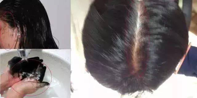 洗头别傻傻去店里染发了！洗头加点它，10年白发转黑了，后悔没早知道