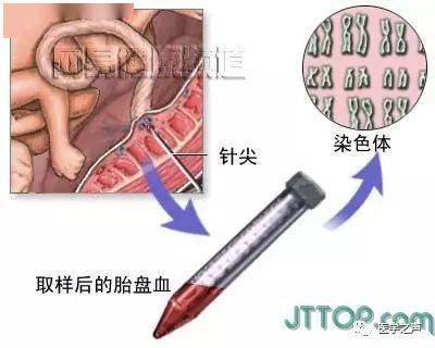 这么全的人体解剖全图 ，必须收藏！