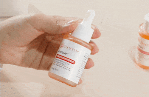 医学长了脂肪粒到底挤不挤?一分钟教你处理它的正确姿势!