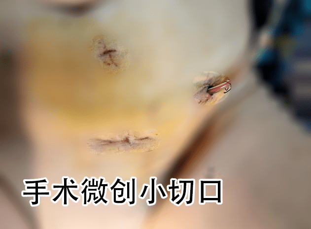 外陰瘙癢一查竟是惡性腫瘤女人有病千萬不要委屈自己