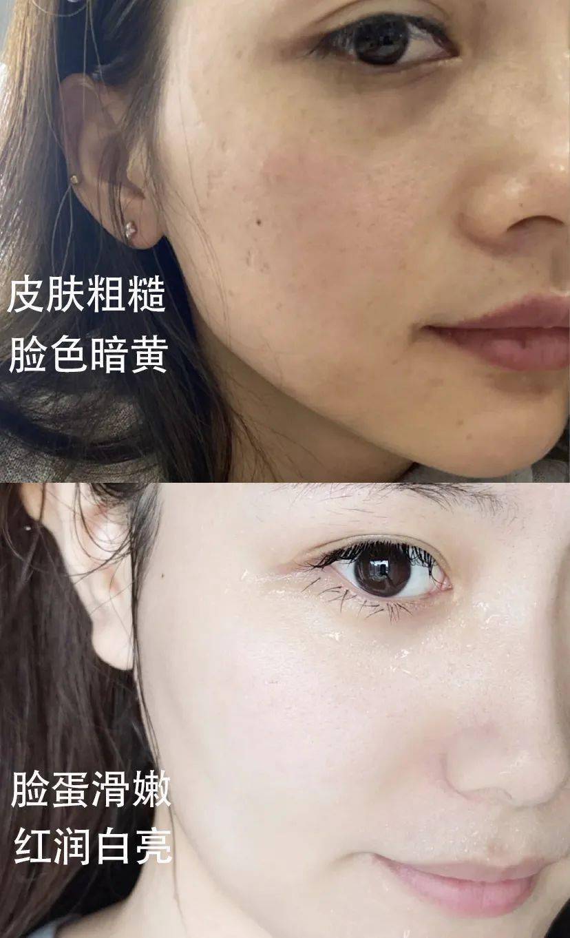 品牌立省近500!抢雪花秀“零差评”水乳6件套,补水滋润,提亮肤色